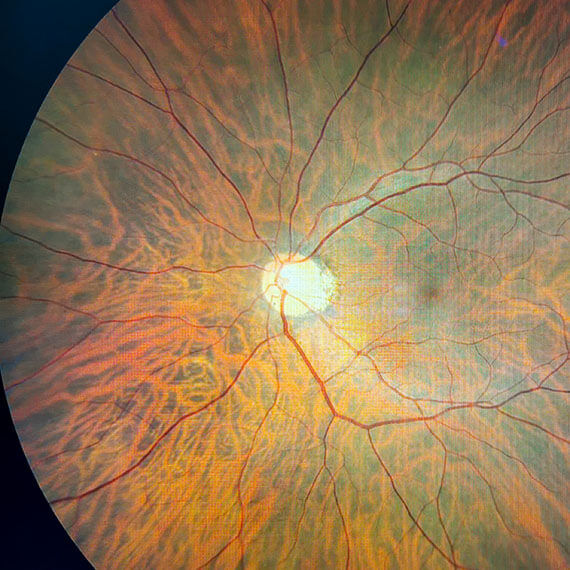 Retina Scan